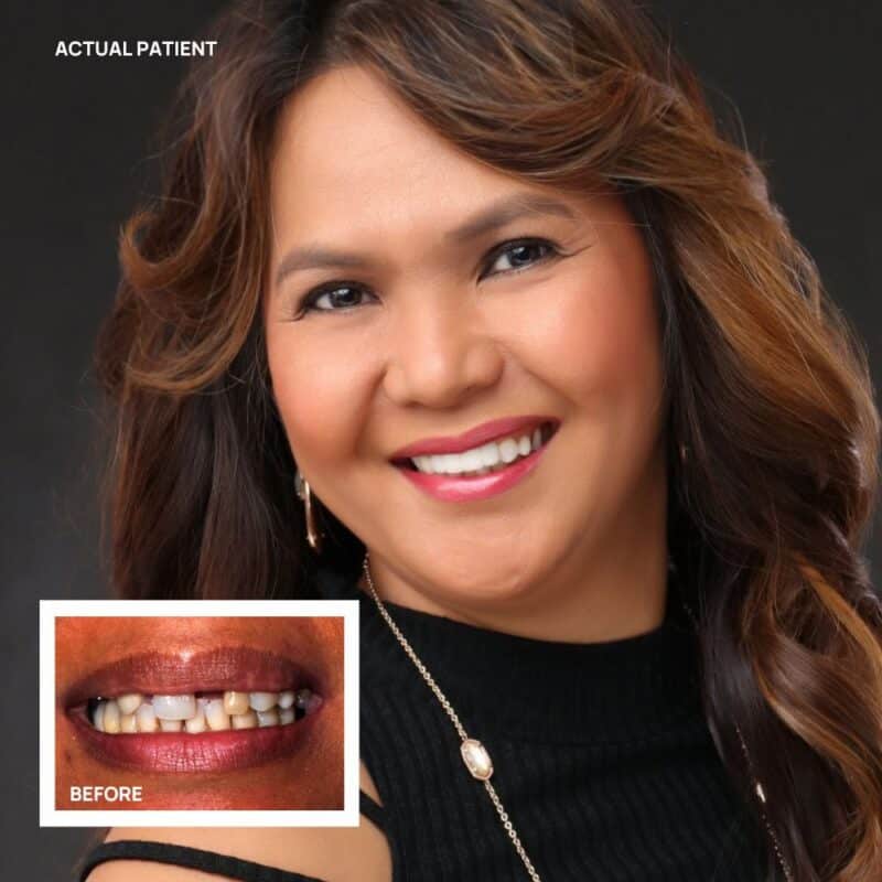 Dentures Stonebriar Smile