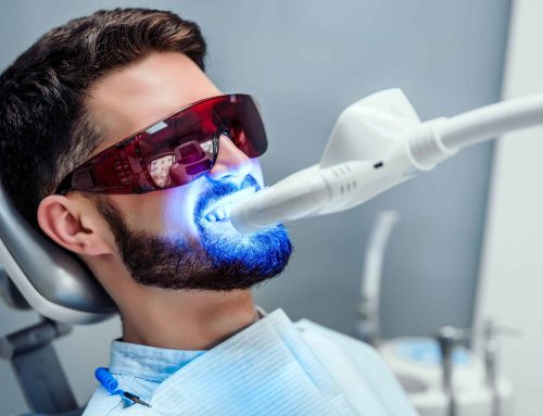 Teeth Whitening: How to Get the Best Bang for the Buck