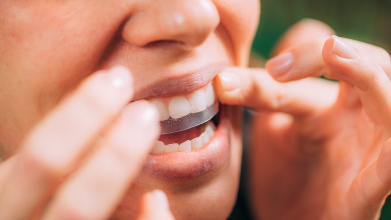 young woman putting whitening strip on upper teeth