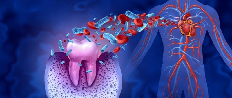 tooth with bacteria leading to heart