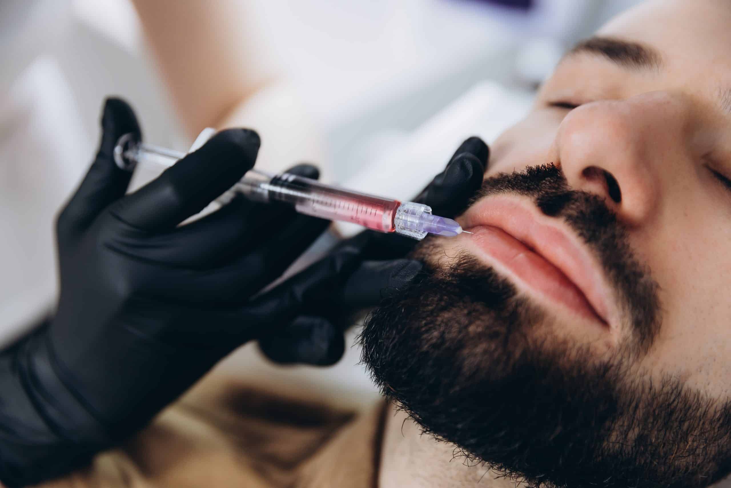 Man with dark beard gets lip injections