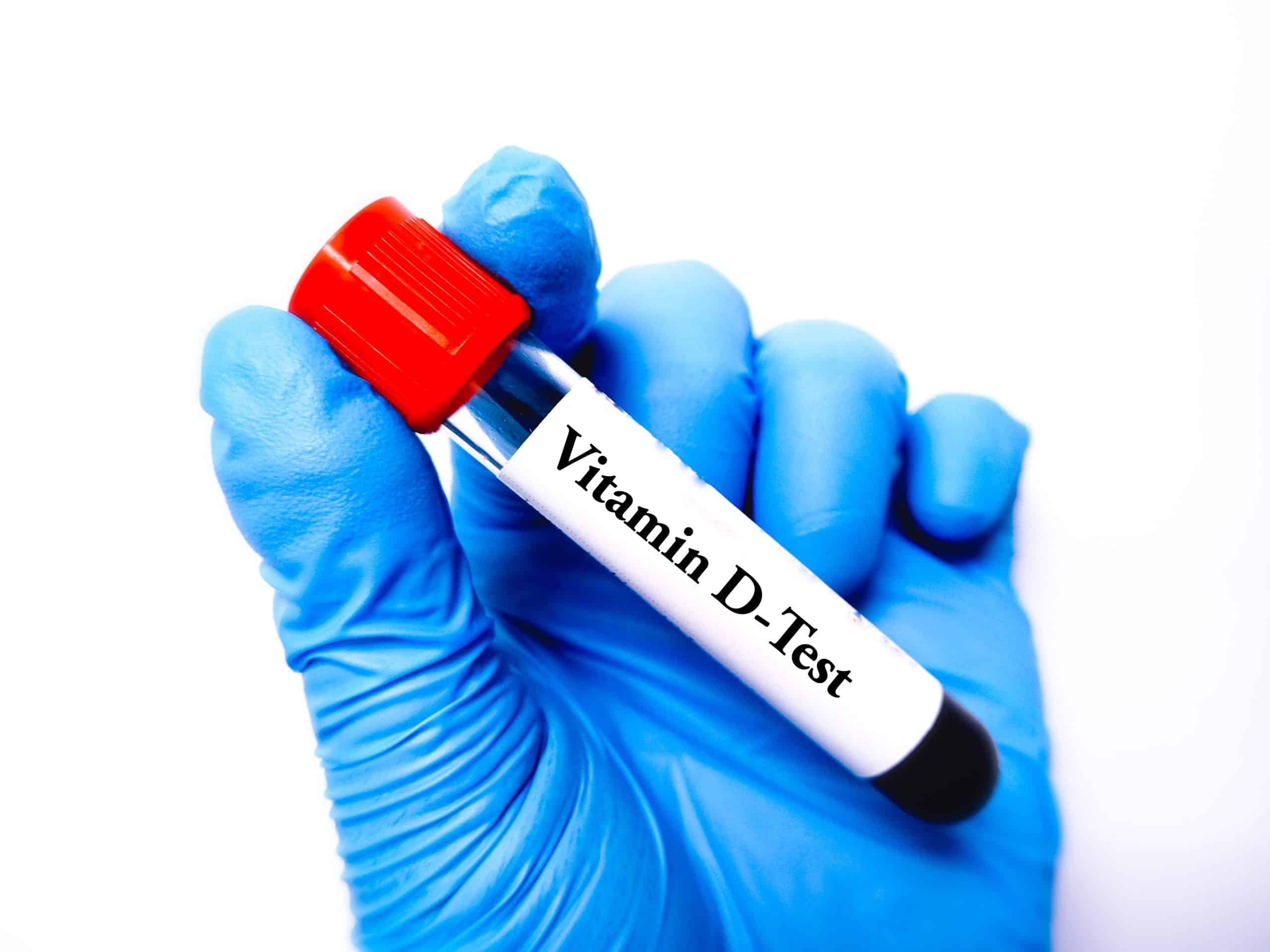 test tube labeled vitamin d