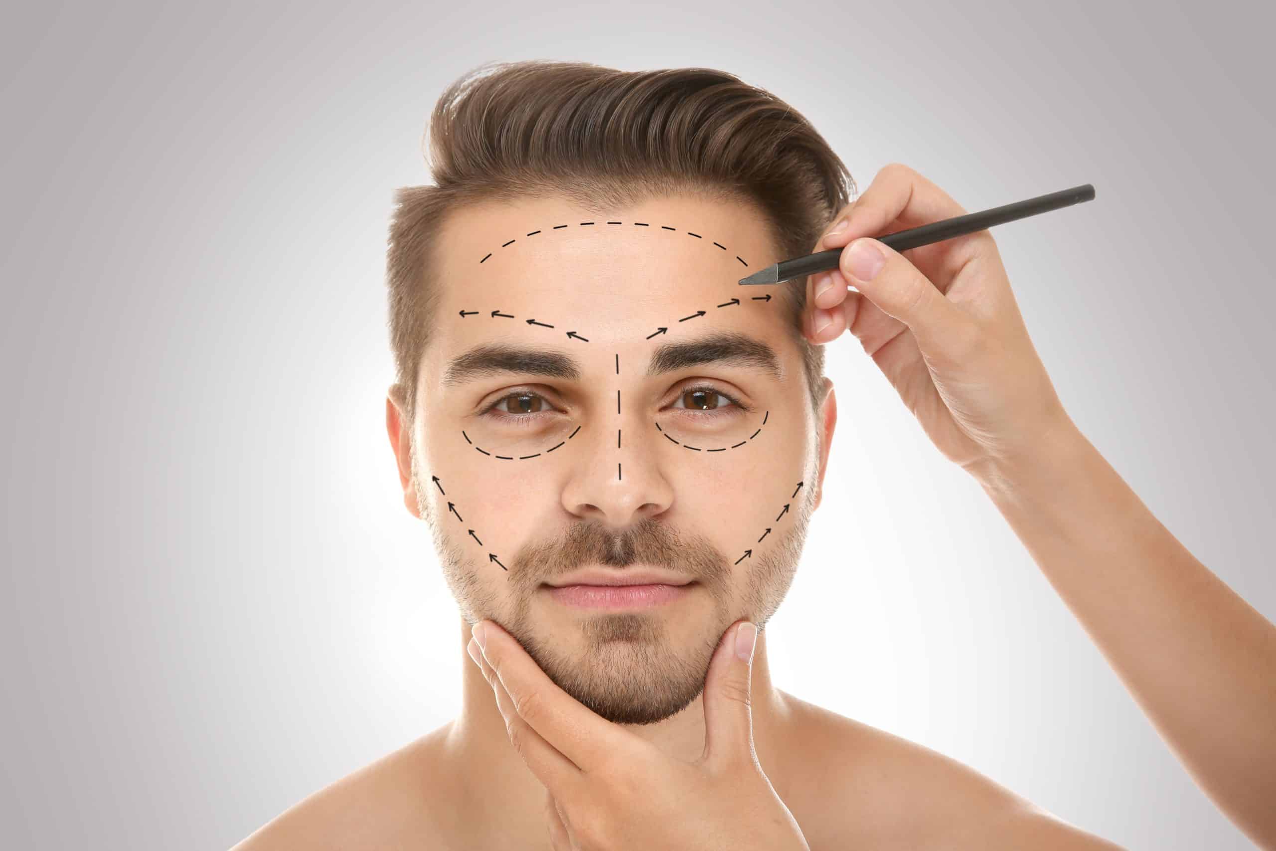 surgeon drawing marks on man's face