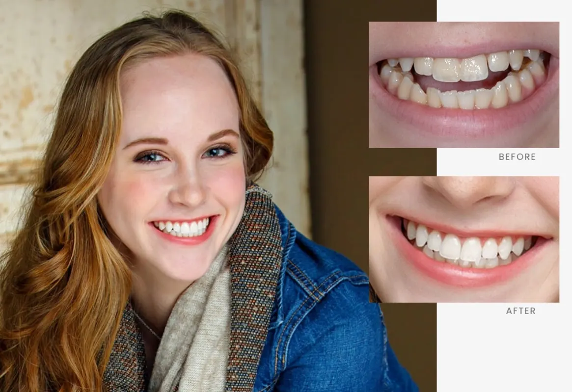Stonebriar Smile Design patient case 8, before and after