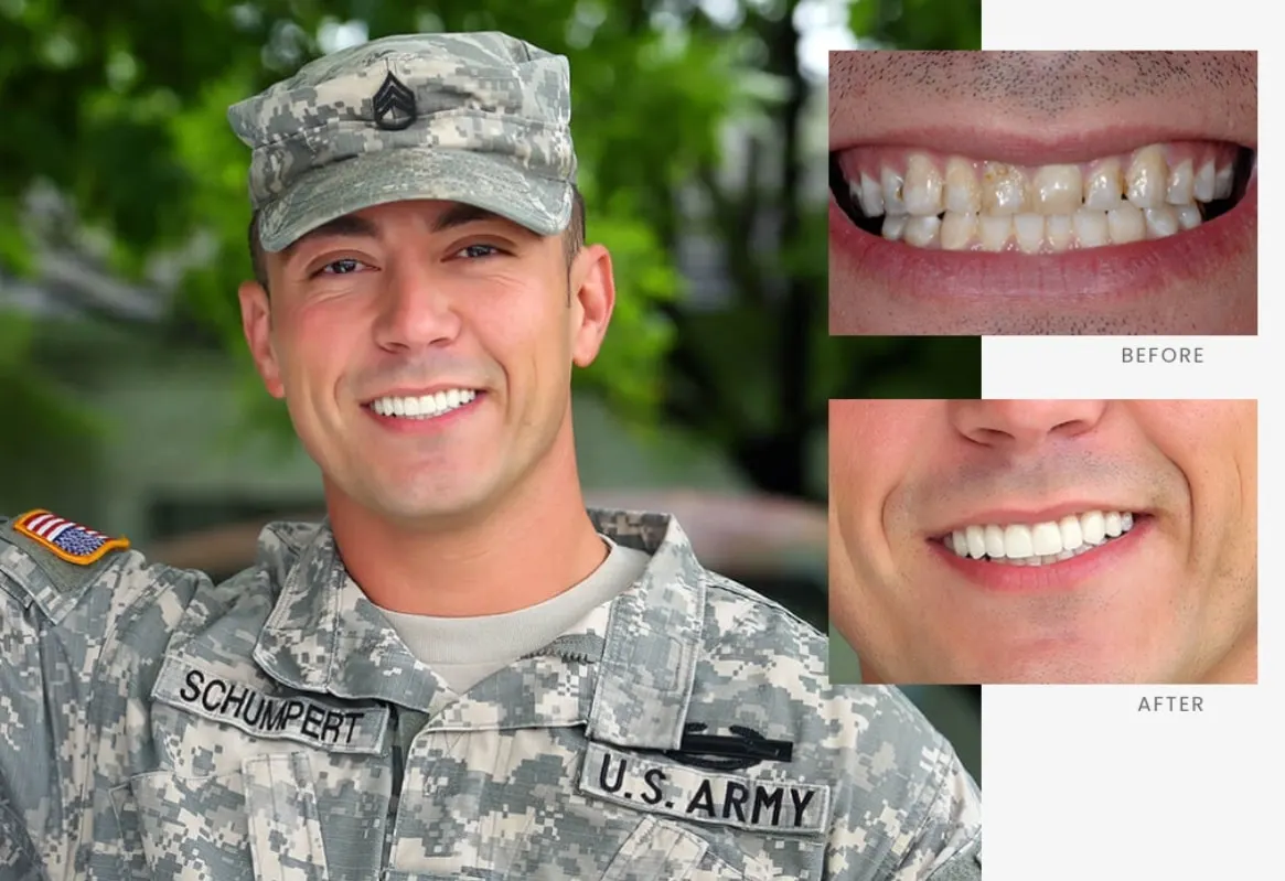 Stonebriar Smile Design patient case 9, before and after