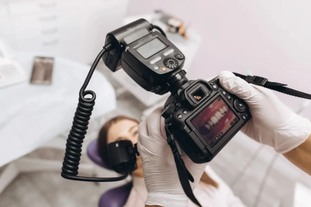 High-definition dental photography used to document a smile