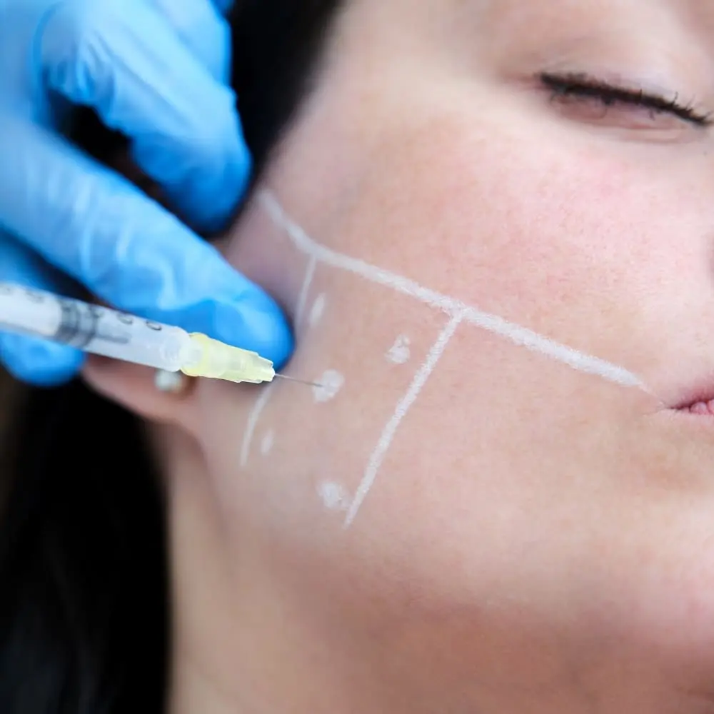 Facial aesthetics consultation at Stonebriar Smile Design