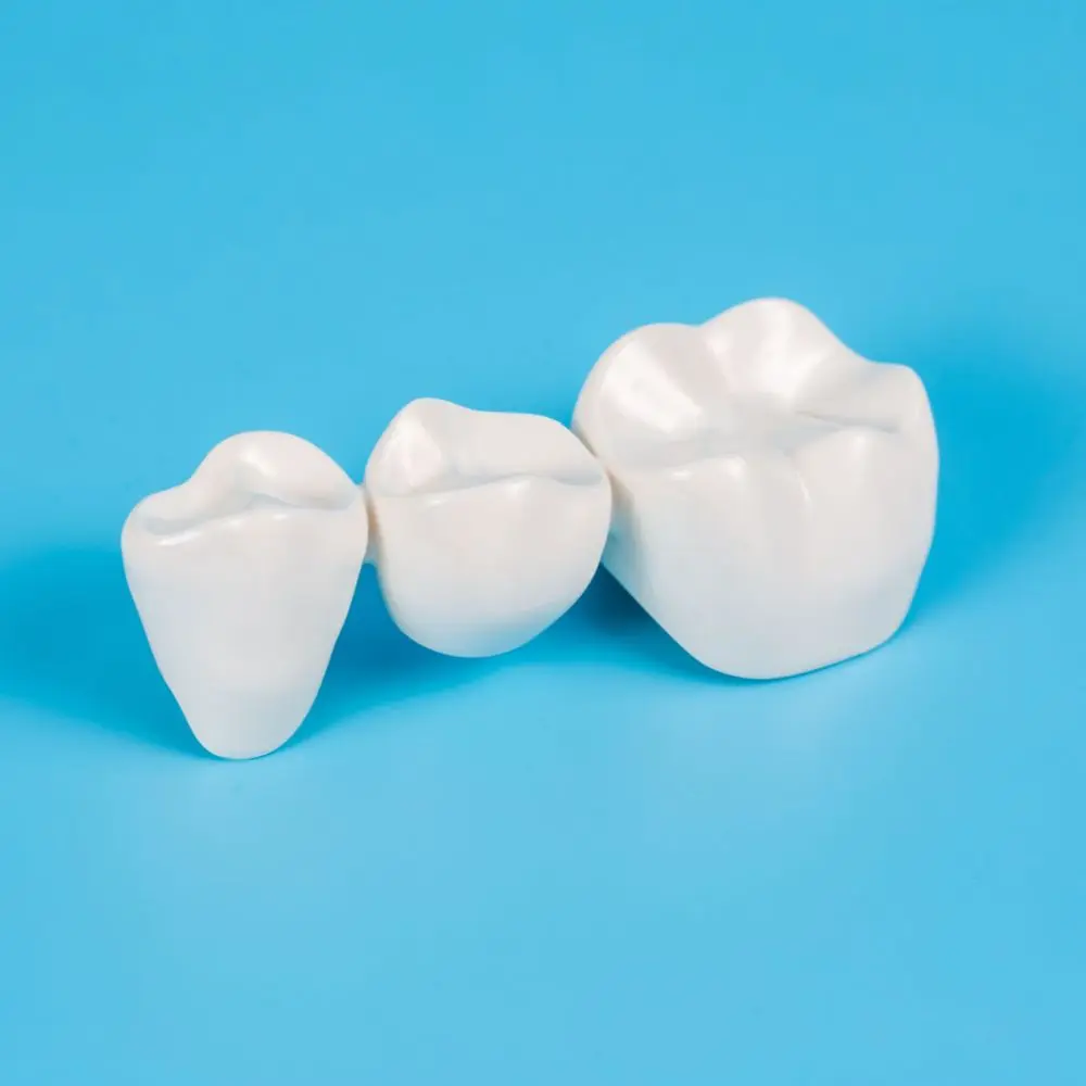 Dentist preparing a personalized dental bridge restoration