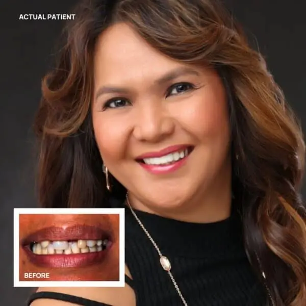 Patient exploring personalized tooth-replacement options