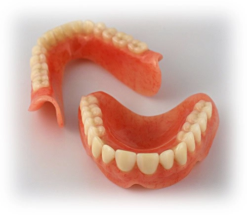 Full denture replacing an entire arch of teeth