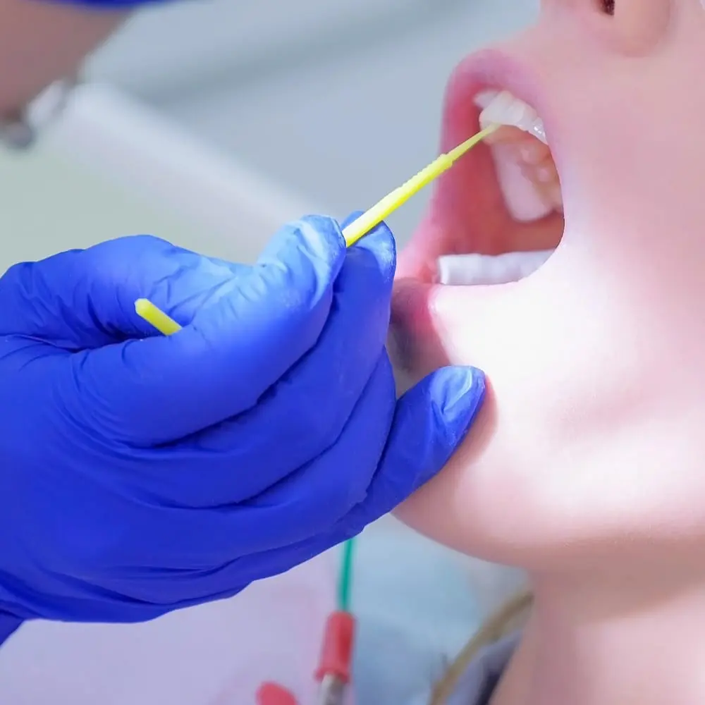 Clinician applying a preventive fluoride treatment