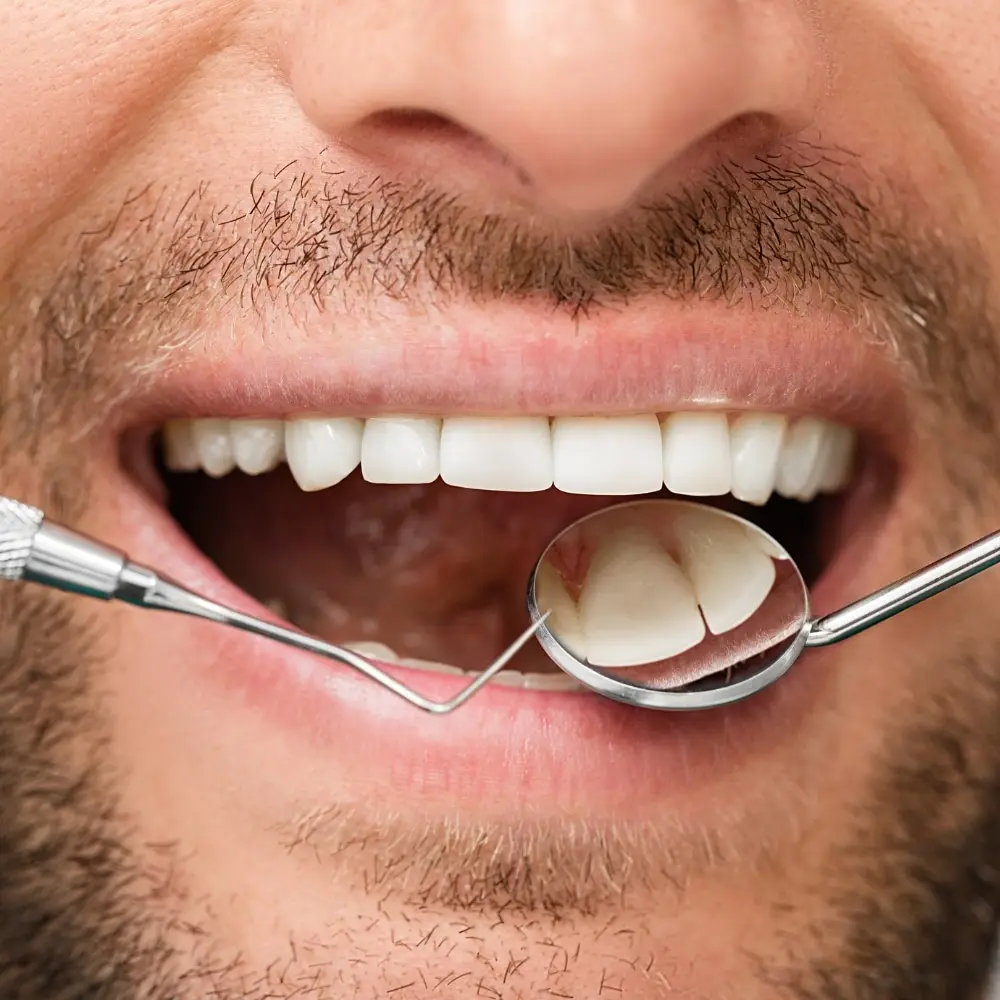 Balanced gumline framing a patient's smile