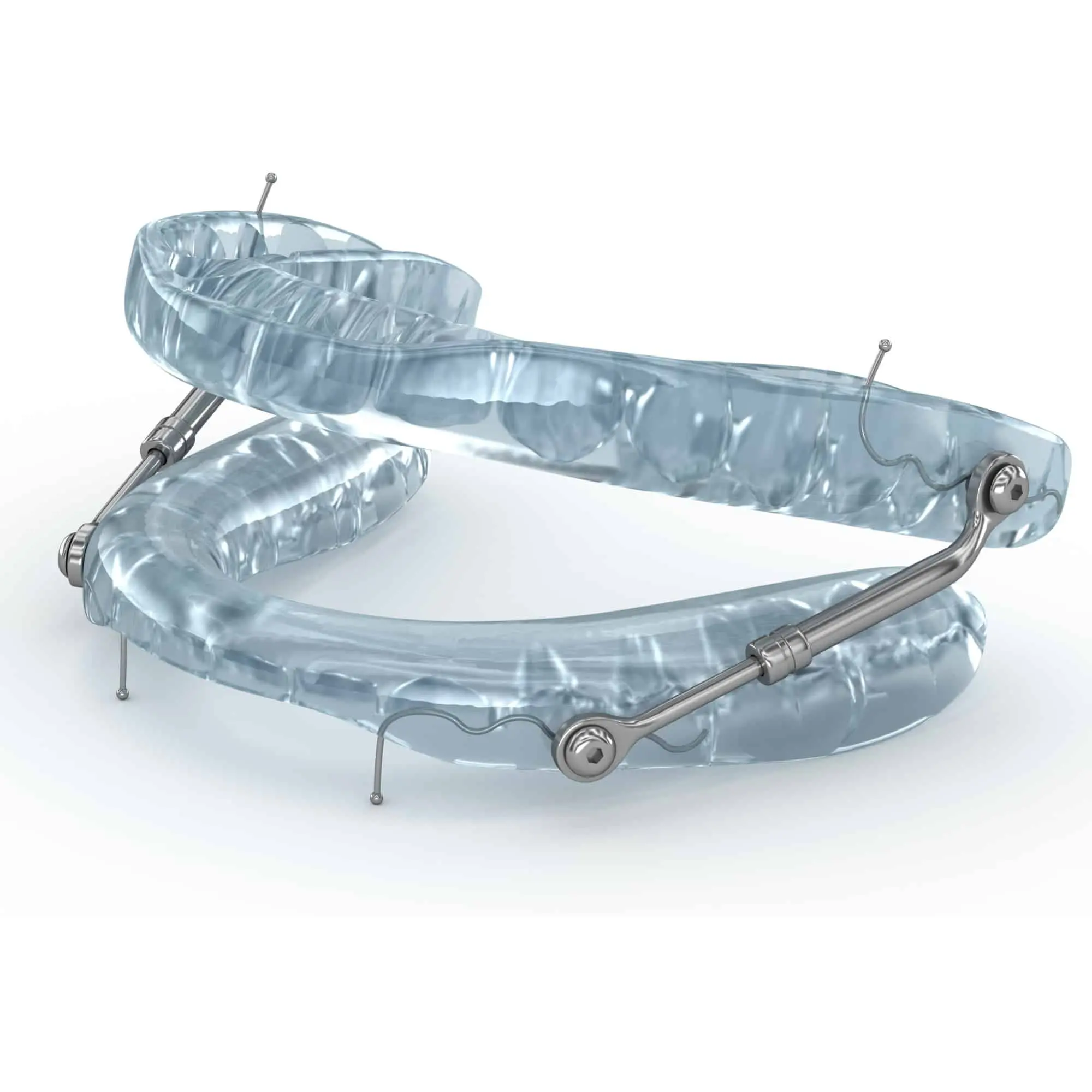 Custom oral appliance designed to support breathing during sleep