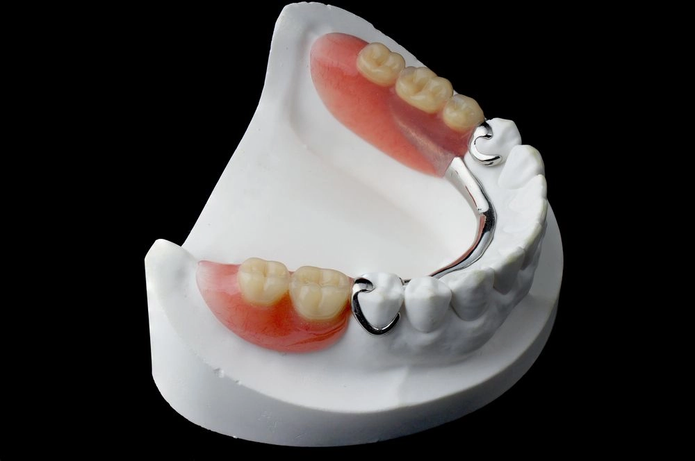 Partial denture designed to fit between remaining natural teeth