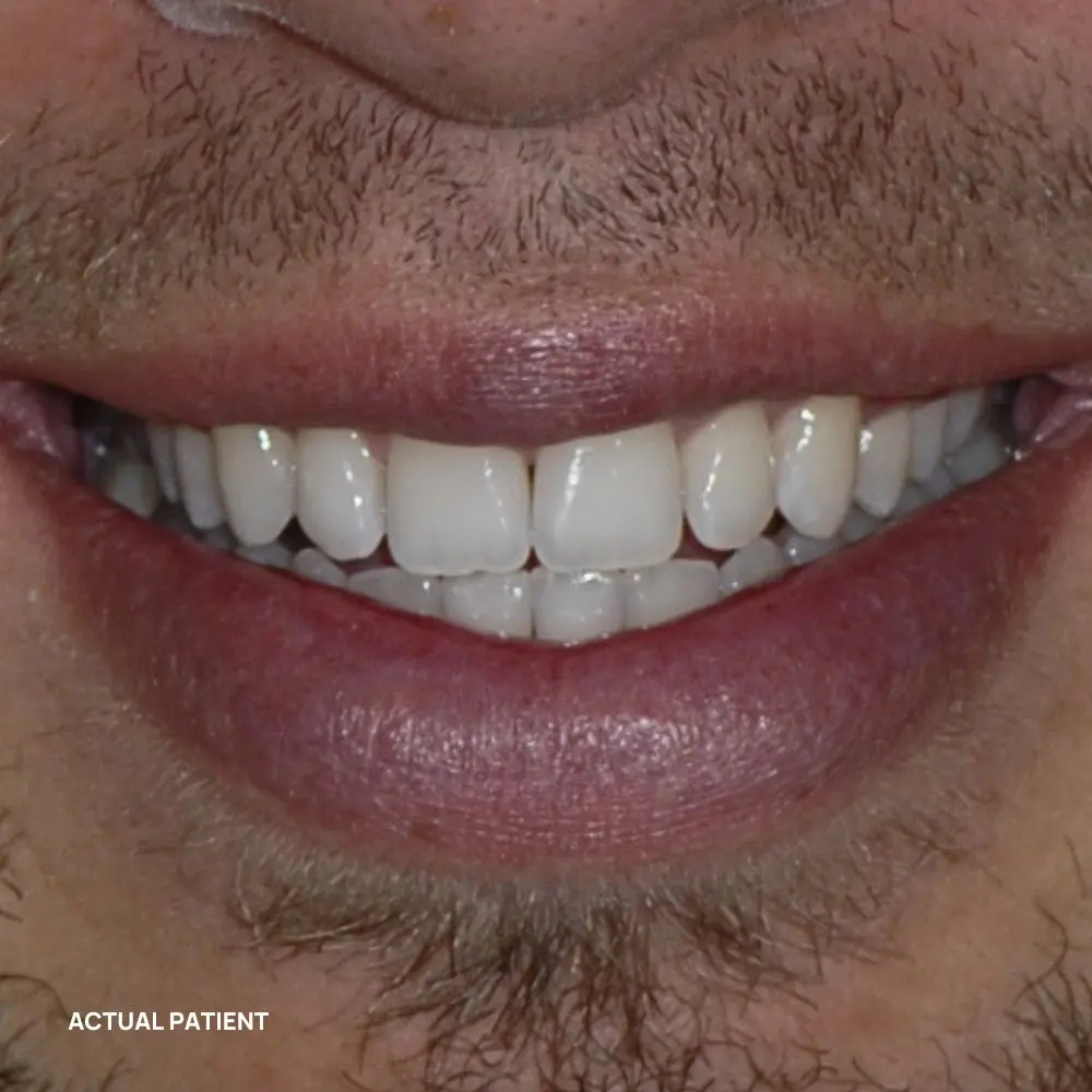Smile after a personalized cosmetic makeover