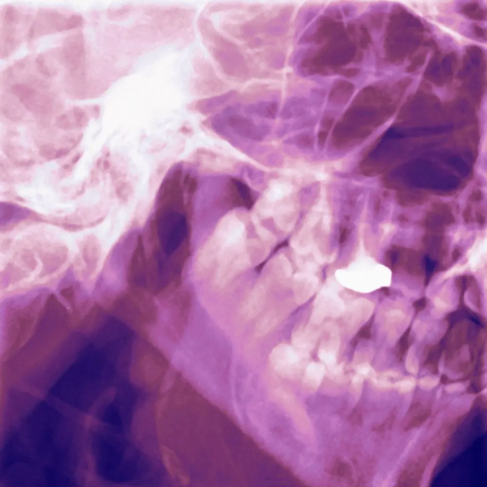 Digital dental evaluation supporting personalized TMJ treatment planning