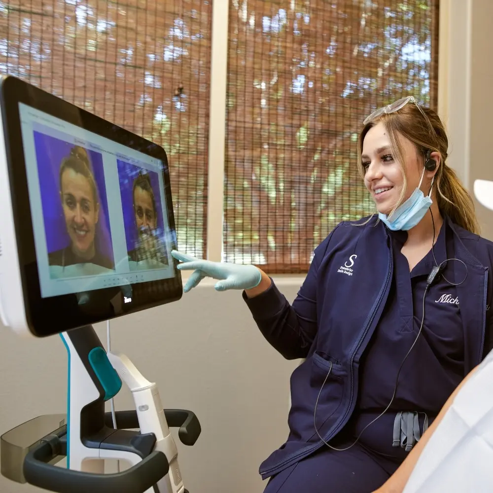 Digital software previewing a future smile
