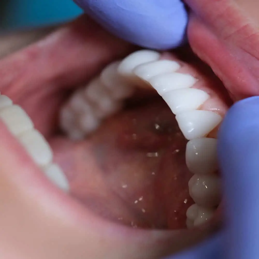 Dentist reviewing a personalized wellness plan with a patient