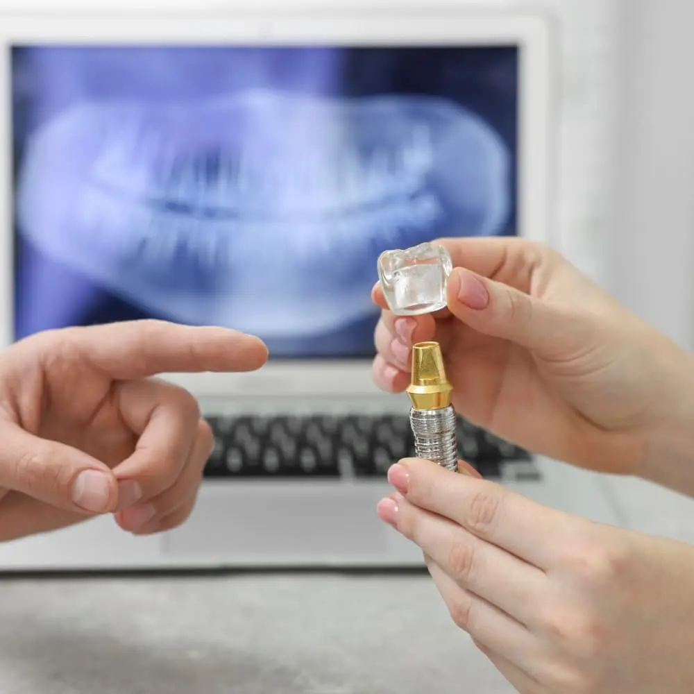Dental implant restoration replacing a missing tooth
