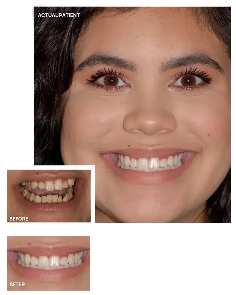 A Stonebriar Smile Design patient smiling confidently