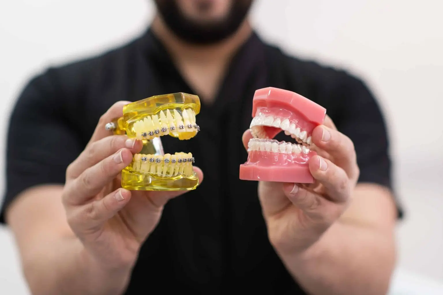 Dental models comparing traditional braces and clear aligners
