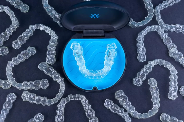 Invisalign: Everything You Need to Know (Part 1)