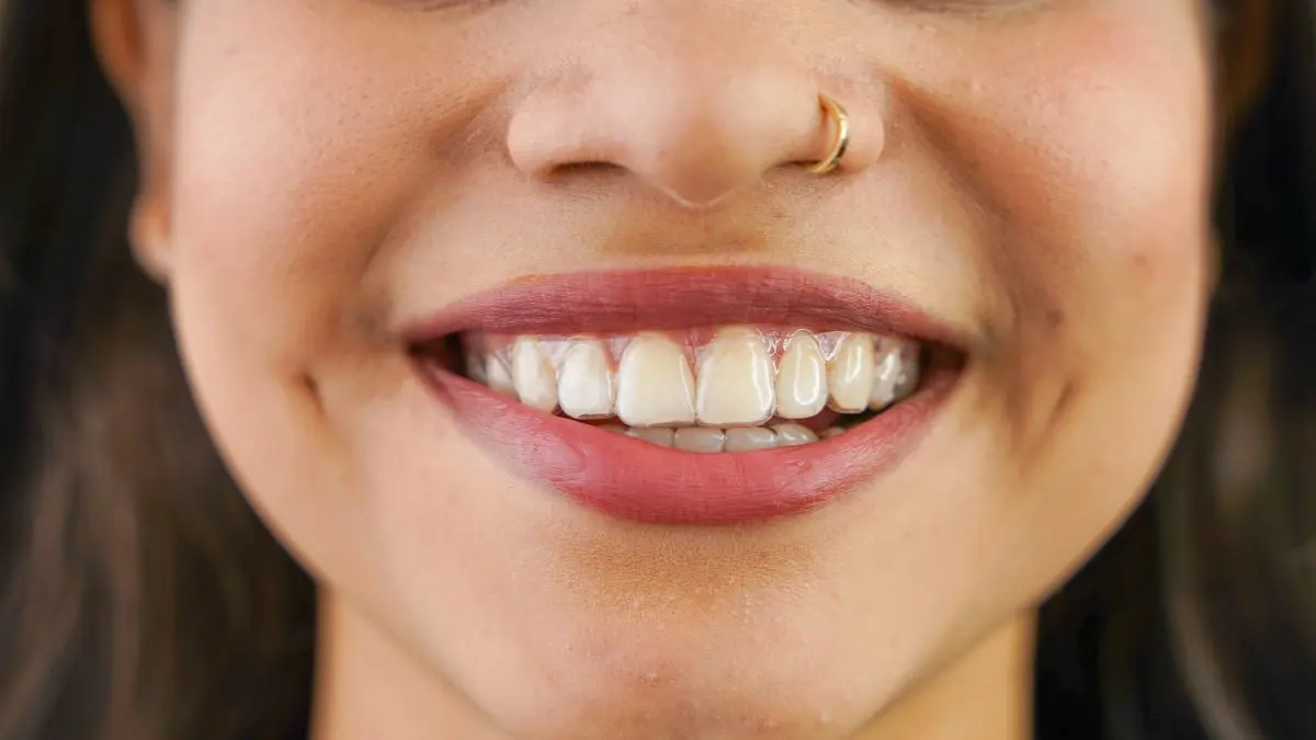 Woman smiling while wearing clear dental aligners