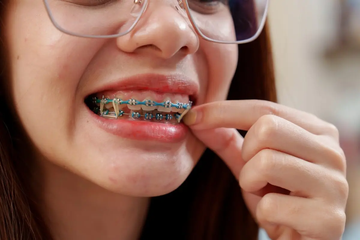 Patient adjusting elastic bands on traditional metal braces