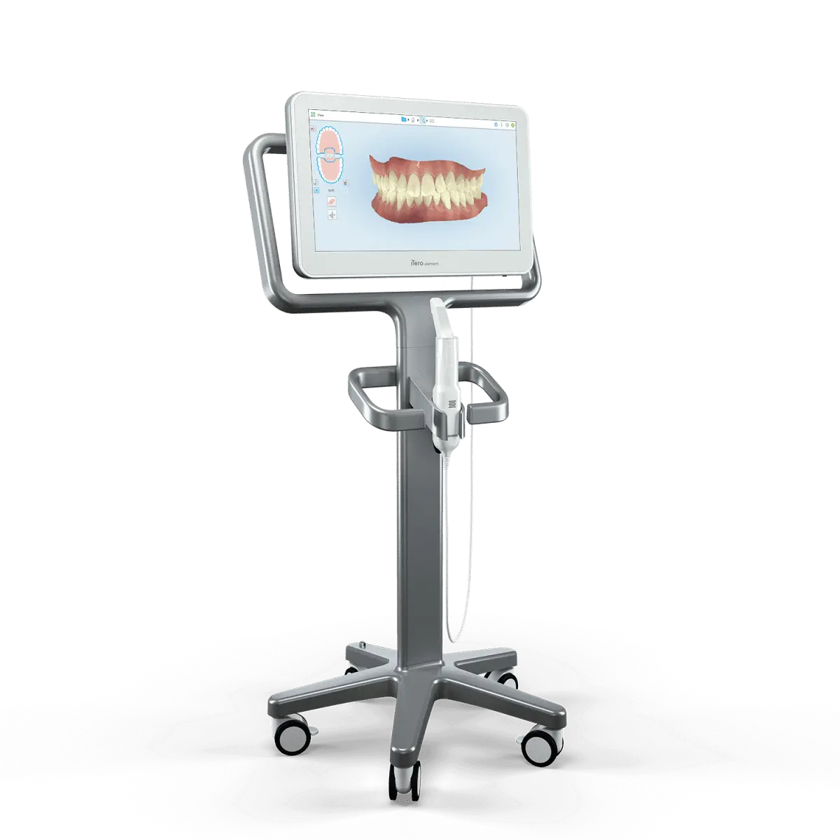 iTero digital scanner used to plan Invisalign treatment