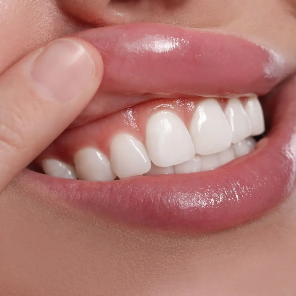 Stonebriar clinician providing personalized periodontal care